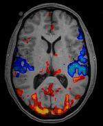 Combinatie mri-scan en petscan van bloedtransport in de hersens.