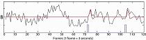 EEG-scan