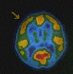 Pet scan toont de biochemische oorzaak van zogenaamde noumenale ervaringen.