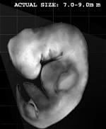 Staart bij menselijk embryo