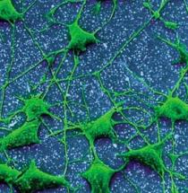 Met elkaar verbonden zenuwcellen of neuronen vormen neurale netwerken die informatie doorgeven met behulp van chemicali&euml;n en electrische stroompjes.